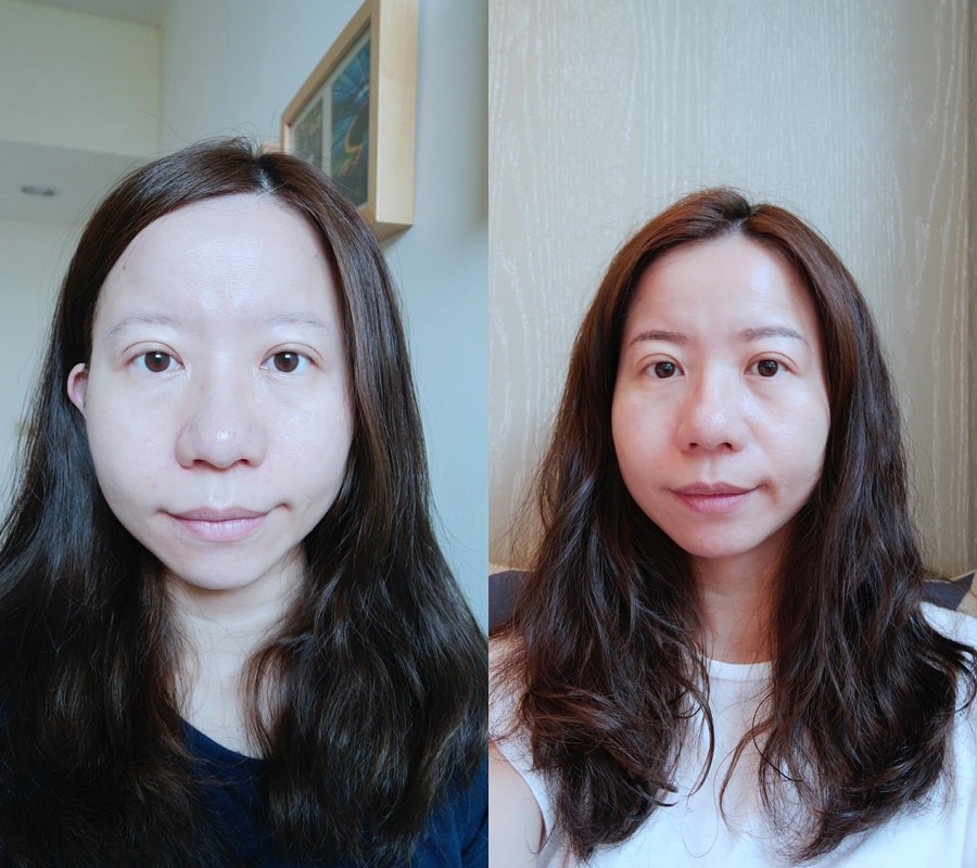 醫美微整│美麗爾診所韓國BK縫雙眼皮 擺脫雙眼皮貼  出門快10分鐘